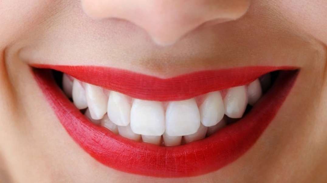 Apple Dental Group _ #1 Teeth Whitening in Miami Springs _ 33166.mp4Apple Dental Group : #1 Teeth Wh
